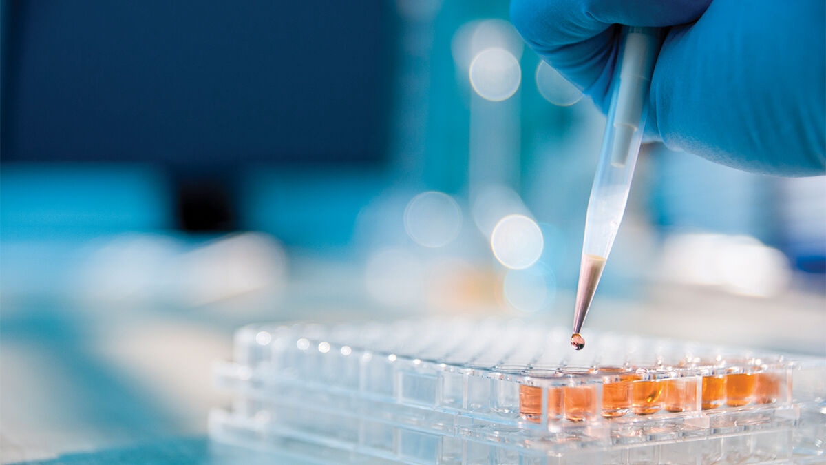 A gloved hand uses a pipette to add liquid to a multiwell plate in a laboratory setting.