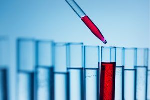 A dropper adds red liquid to one of several clear test tubes.