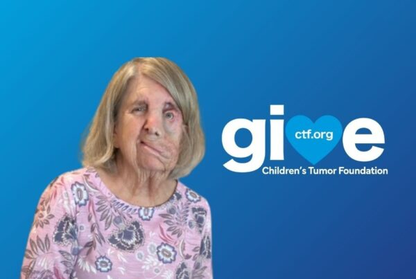 A woman with a facial difference, wearing a pink floral shirt, is in front of a blue background with "give" and "Children’s Tumor Foundation" text and a heart symbol.