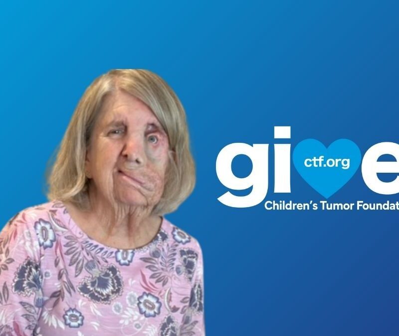 A woman with a facial difference, wearing a pink floral shirt, is in front of a blue background with "give" and "Children’s Tumor Foundation" text and a heart symbol.