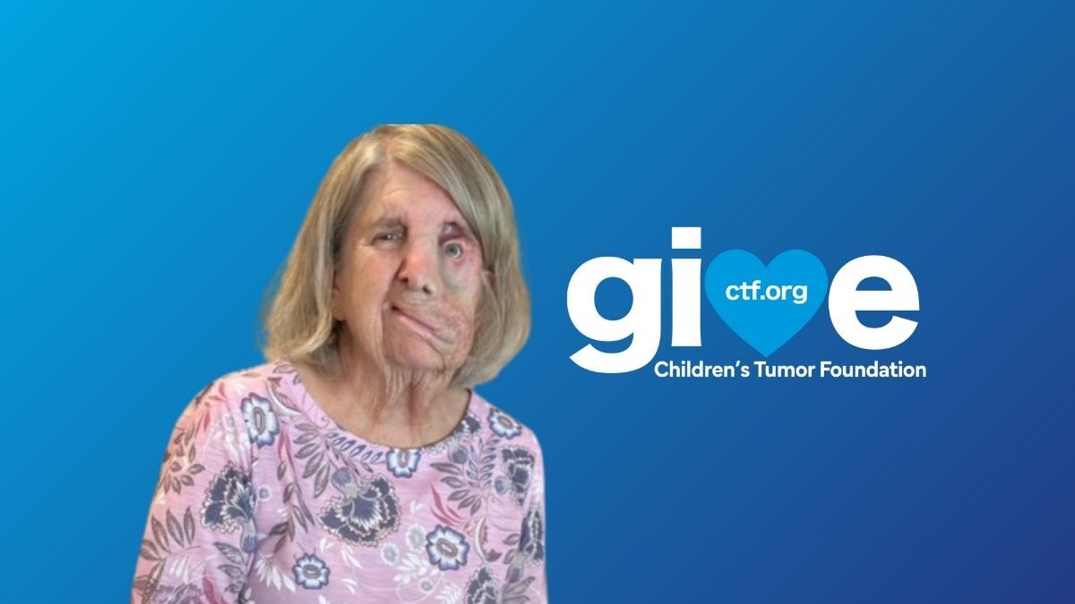 A woman with a facial difference, wearing a pink floral shirt, is in front of a blue background with "give" and "Children’s Tumor Foundation" text and a heart symbol.